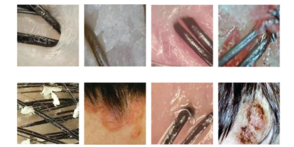 Scalp analysis technology