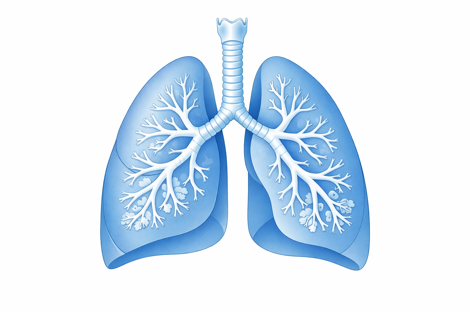 Medical illustration of lungs showing bronchial detail relevant to COPD exacerbation risks