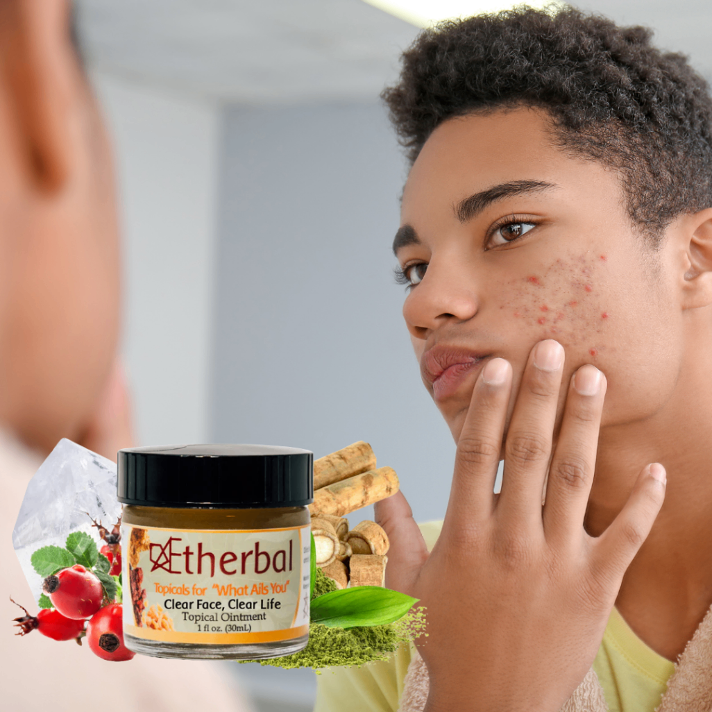 Clear Face, Clear Life Topical Ointment Display