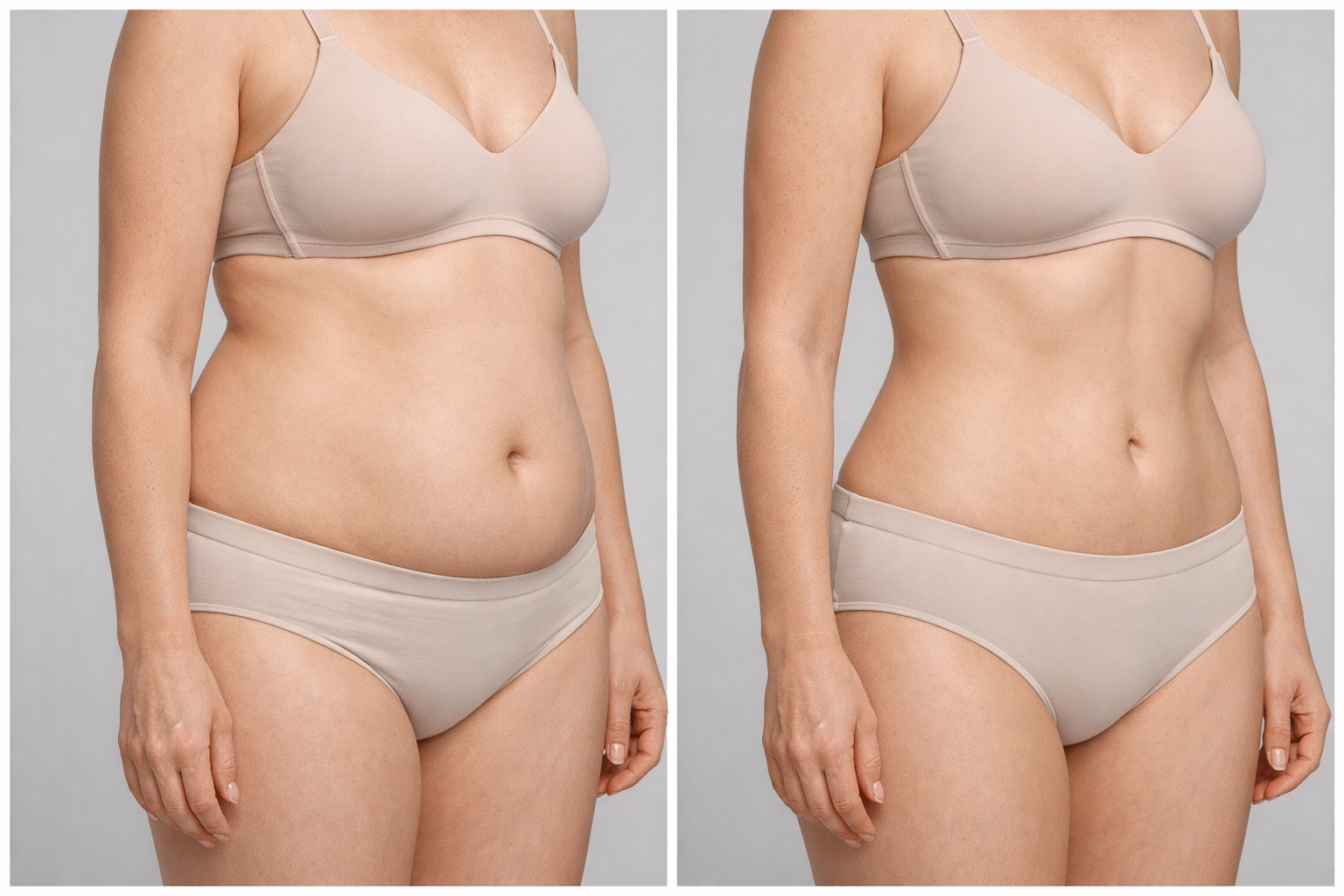Abdomen fat reduction – stock-style before and after