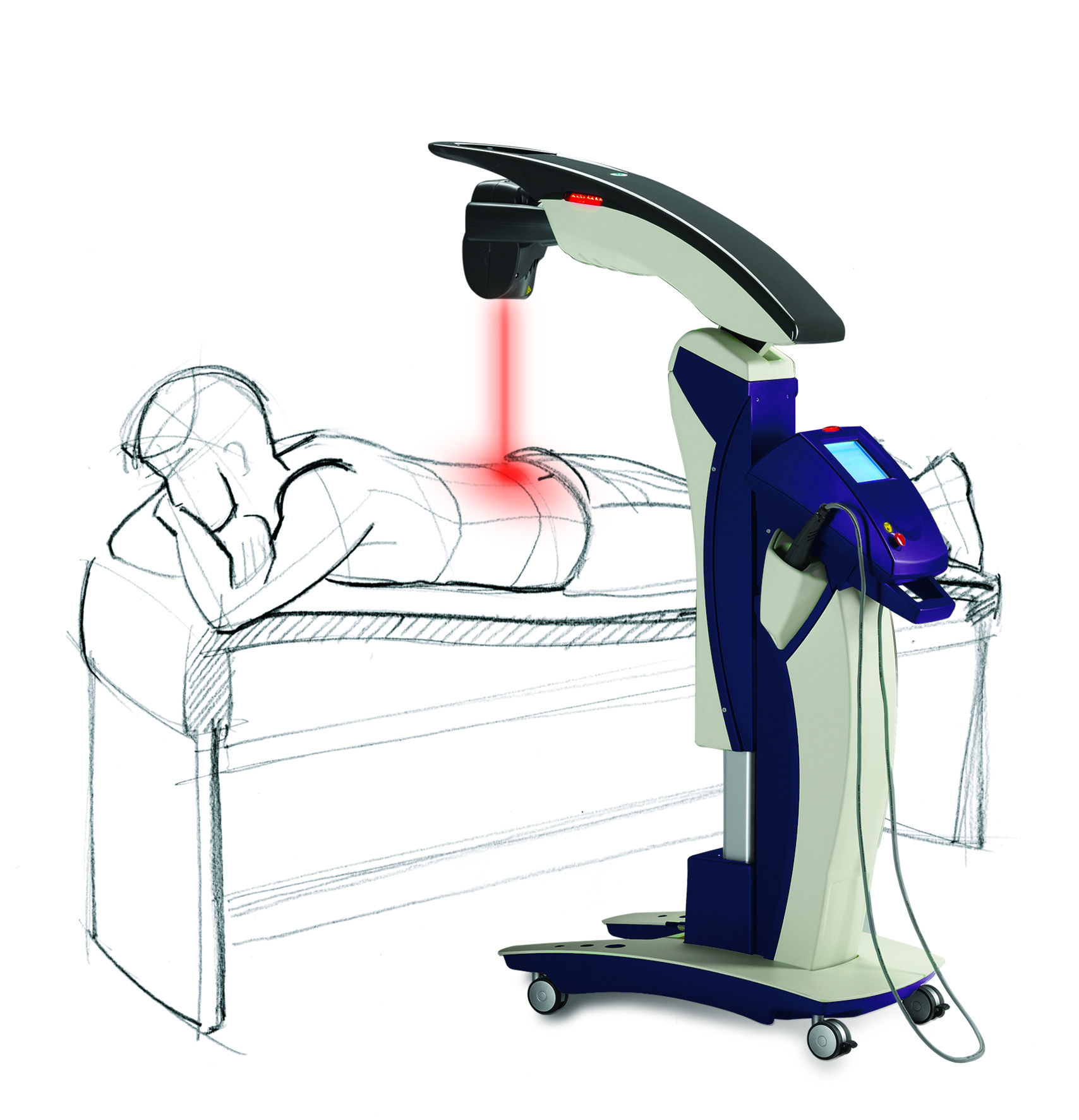 Advanced Laser Treatment