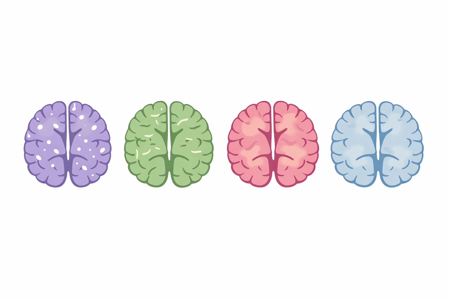 Four brain illustrations comparing different types of dementia including Alzheimer's