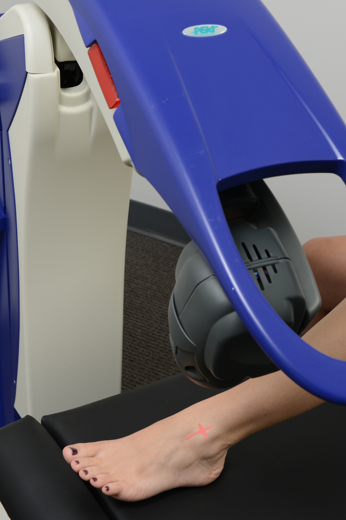 MLS Robotic Laser Therapy on foot