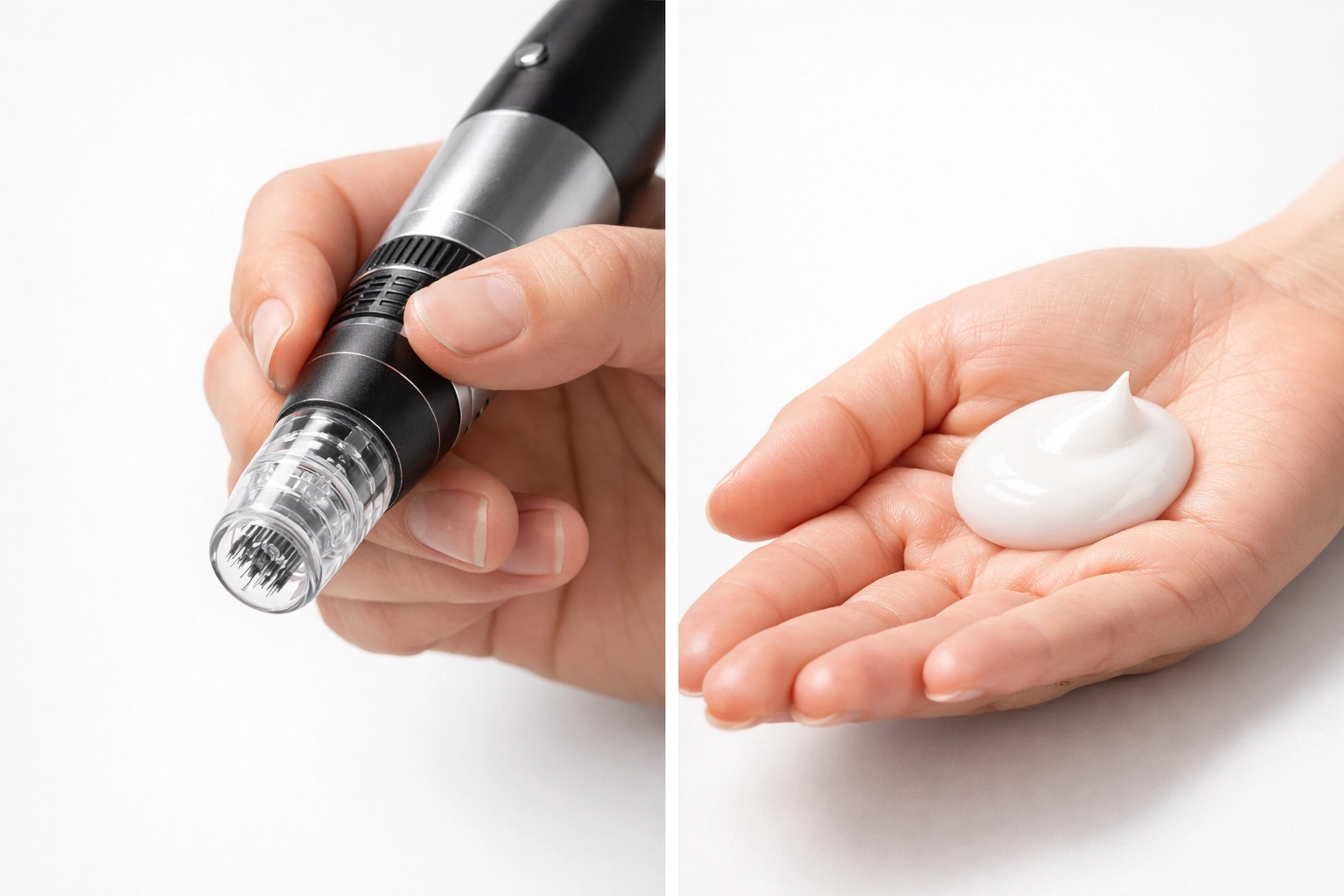 Comparison of traditional microneedling pen device versus SQT bio-microneedling natural treatment