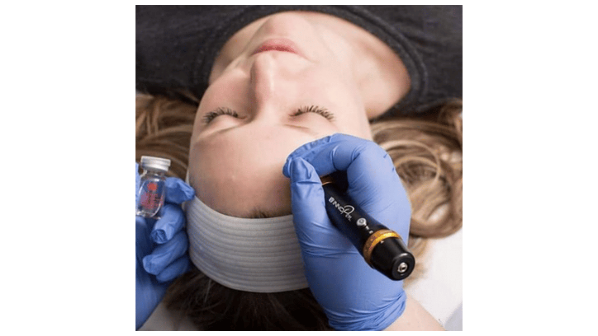 microneedling-precision-treatment-client-spa.png