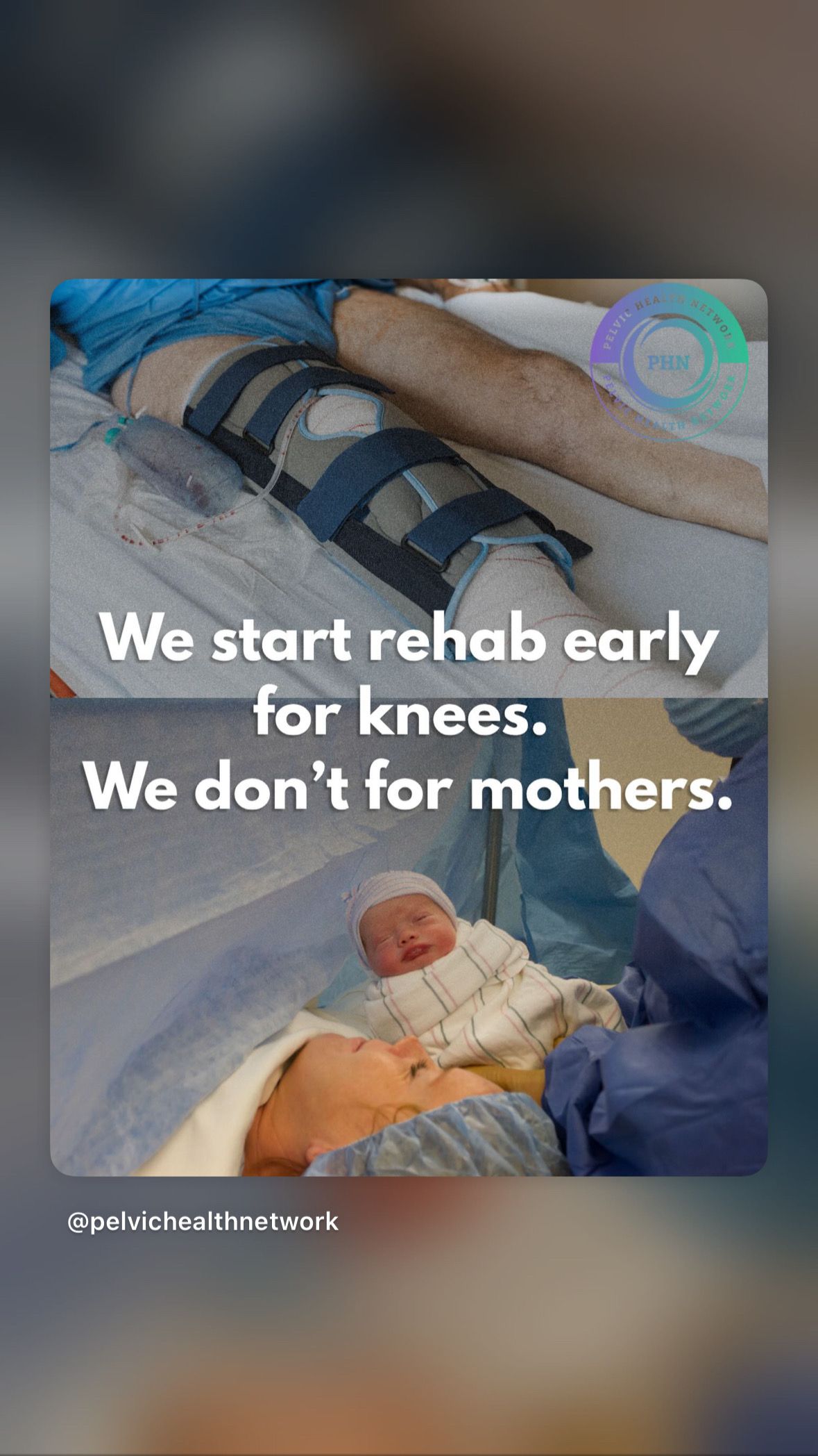 Early rehab comparison.