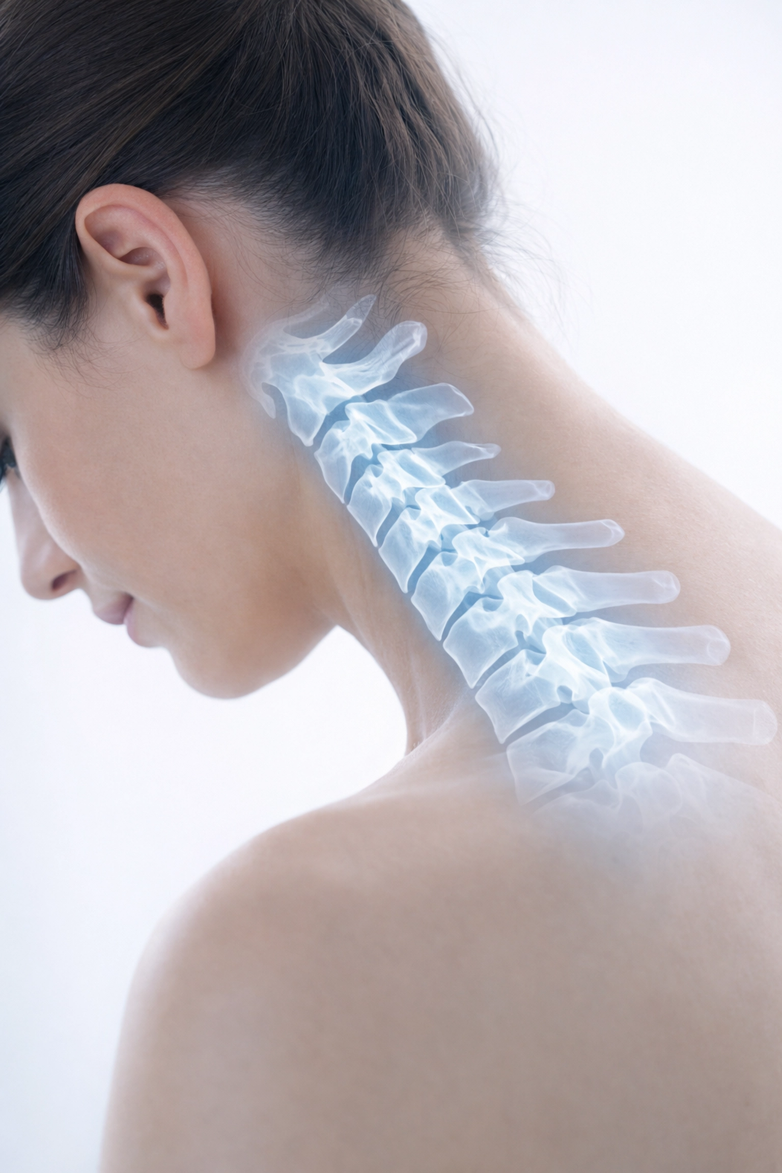 Text neck anatomy showing cervical spine alignment and forward head posture in Los Angeles professional