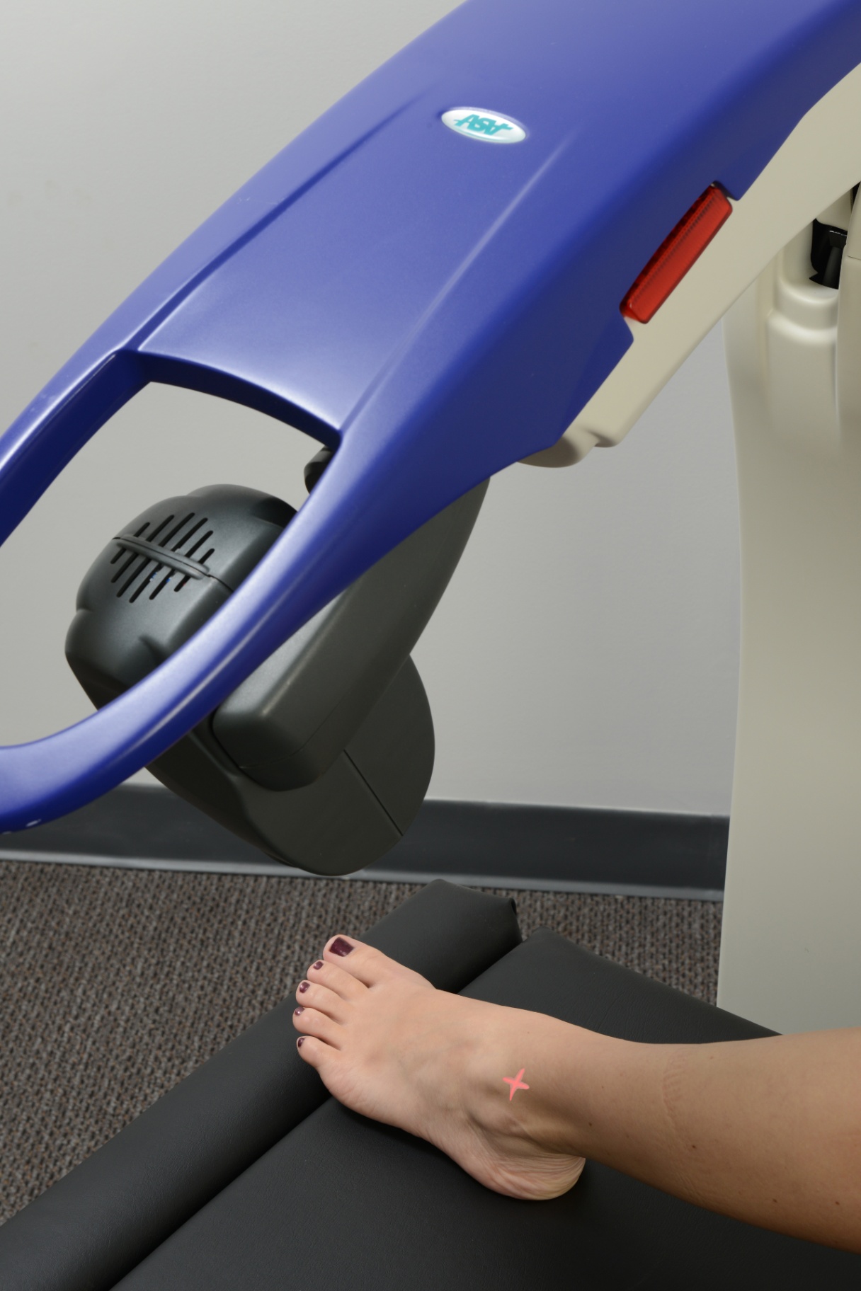 MLS Robotic Laser Therapy for Neuropathy Pain Relief