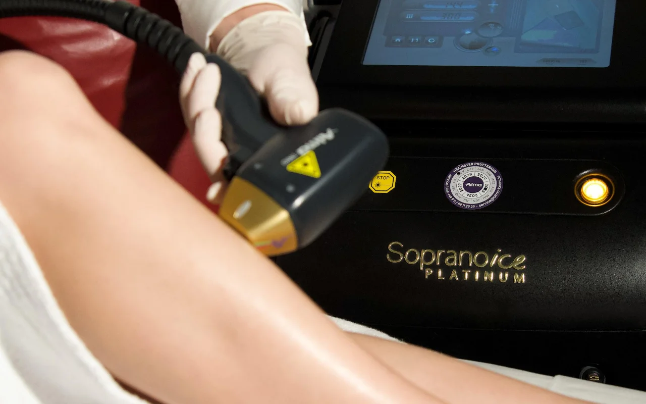 Close-up of a professional laser hair removal session using advanced three-wavelength laser technology