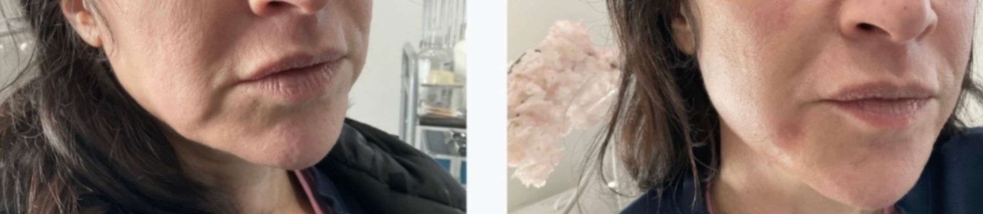 Side-by-side before and after images showing profile balancing results