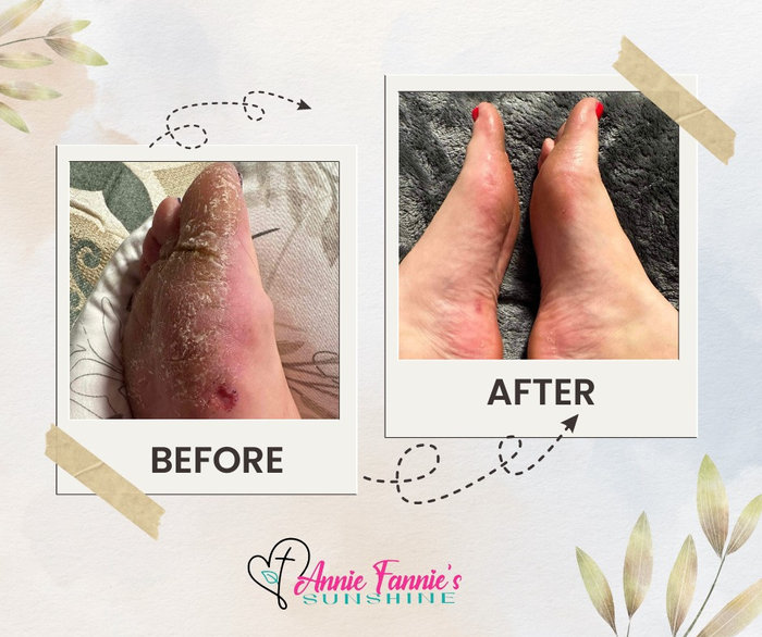 Real-life results (eczema/sensitive skin): dramatic before-and-after. A reminder to check for irritants and switch to simple, clean, consistent care (Two Step Duo + Rectify).